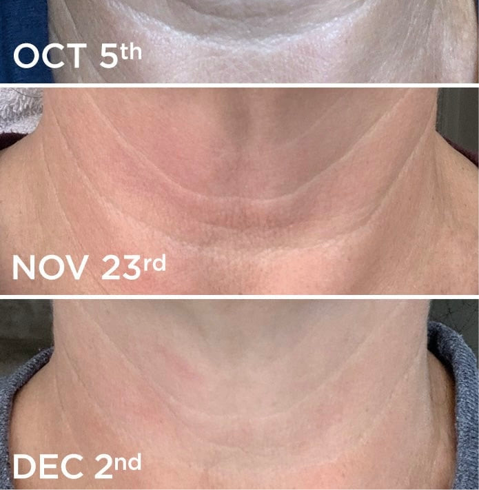 MOTHERS DAY SALE - Seréna Tighten & Lift Neck Cream