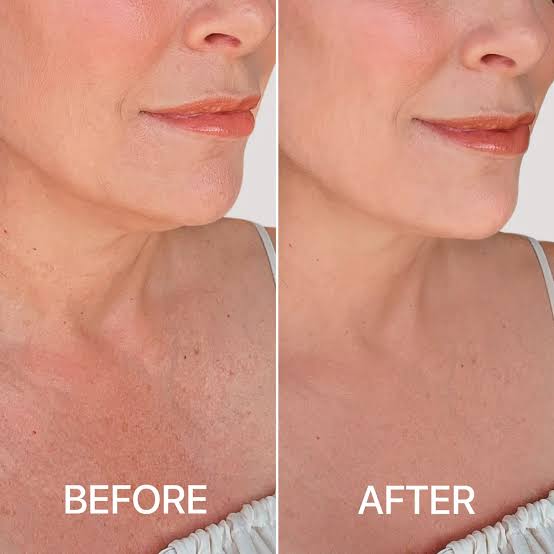 MOTHERS DAY SALE - Seréna Tighten & Lift Neck Cream